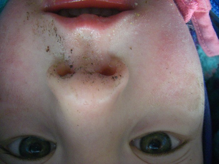 Katmai's shot: his own upside down face